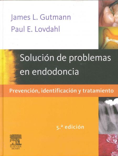 Solucion de Problemas En Endodoncia 5ª Edicion