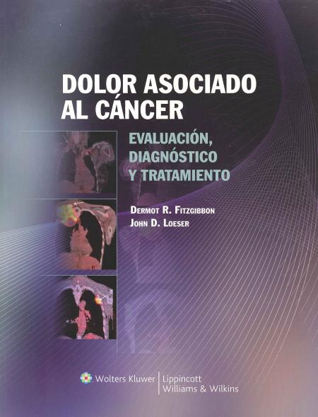 Dolor Asociado Al Cancer Evaluacion, Diagnostico y Tratamiento