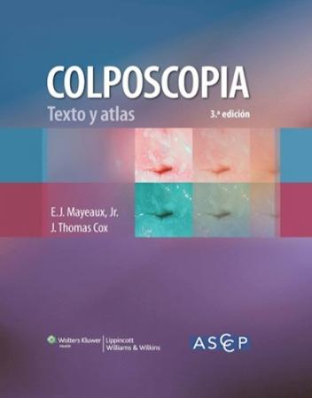 Colposcopia Texto y Atlas 3ª Edicion