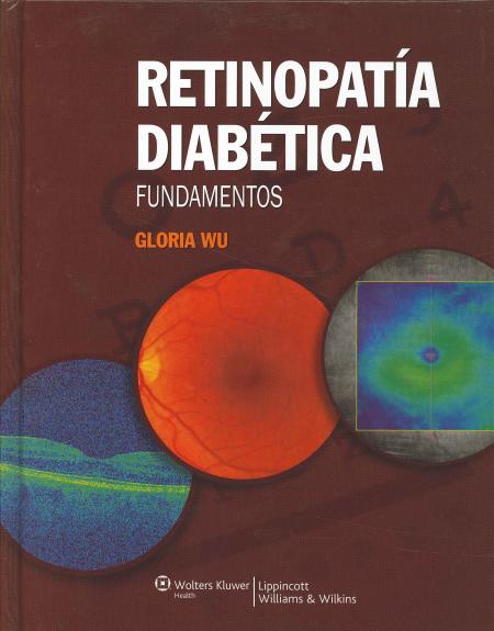 Retinopatia Diabetica Fundamentos